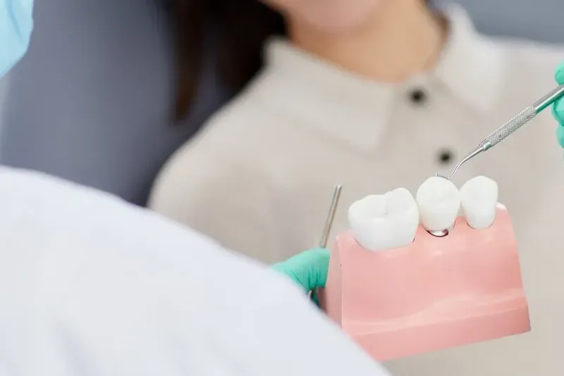 Dentfix beratung Dentfix beratung